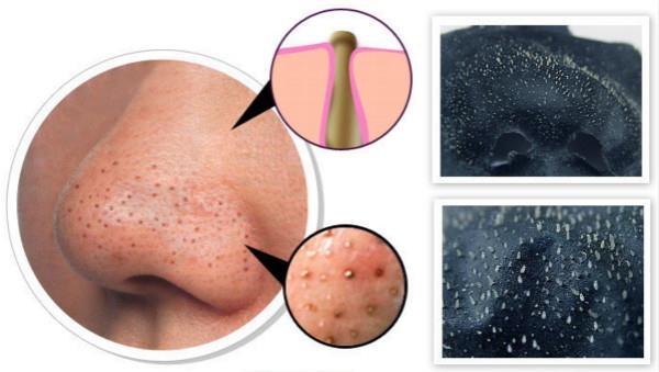 BlackHead-Mask-